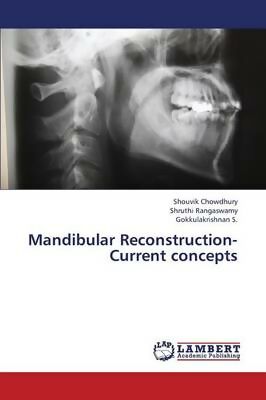 Mandibular Reconstruction- Current Concepts - Chowdhury Shouvik ...