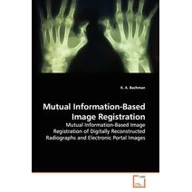 Mutual Information-Based Image Registration