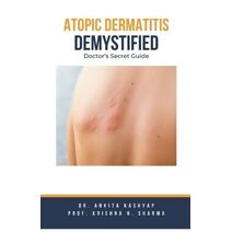 Atopic Dermatitis Demystified